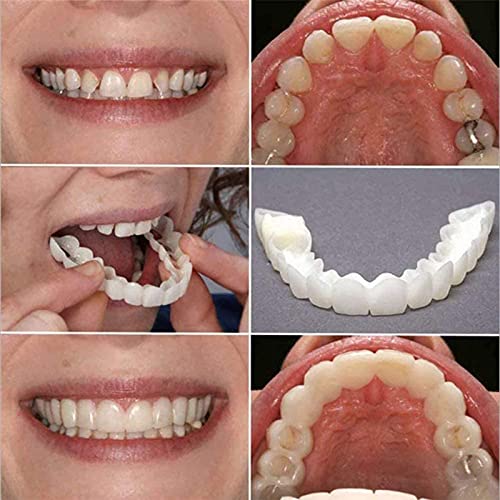 Ulat 5 Piezas (Dentadura Superior para Los Dientes) Reutilizable para Adultos Snap On Smile Blanqueamiento De La Dentadura Fit Flex Cosmetic Teeth Confortable Chapa